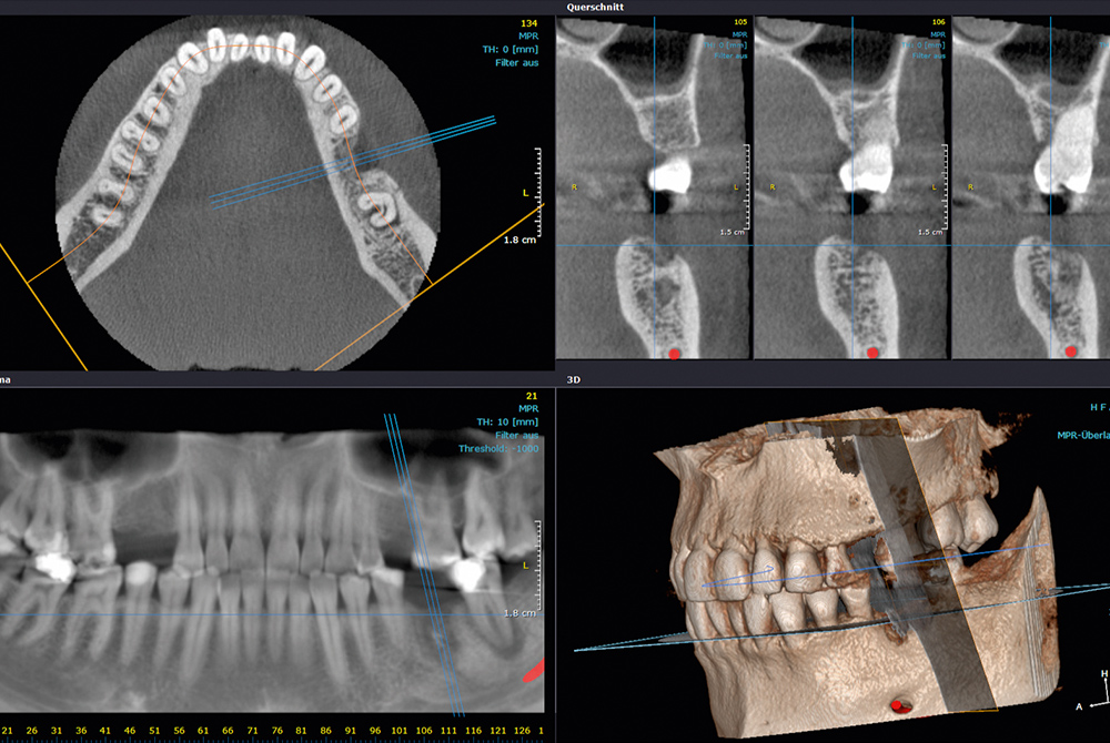 CBCT dijagnostika